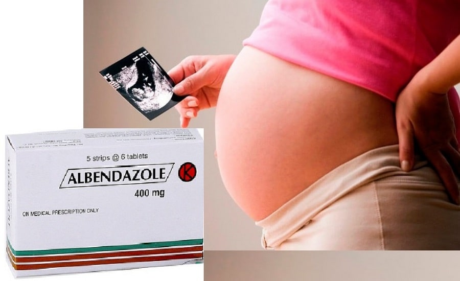 Albendazol-embarazo