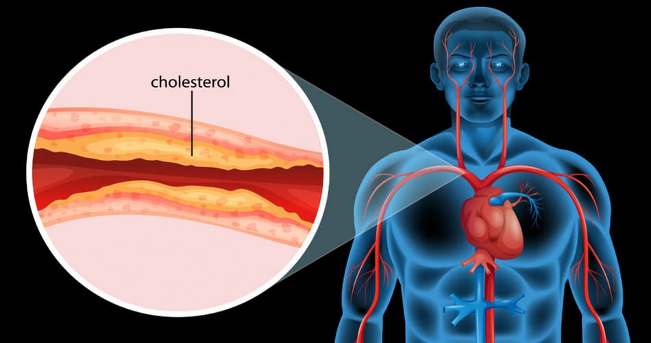 colesterol-alto